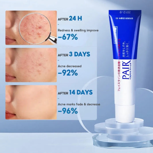 LION Pair Acne Cream 24g